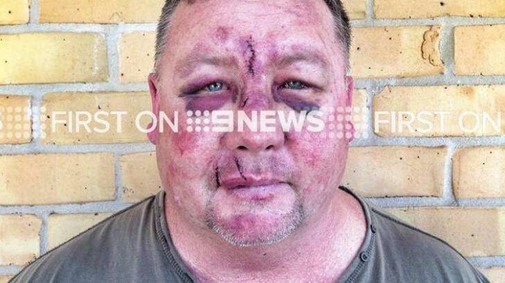 "John" was bashed on the way home from a football game. Photo: Mitch Wall, 9NEWS
