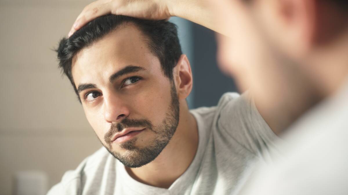 WITHDRAWAL: Male pattern baldness can see the hair retreat from the top of the scalp.