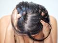 A healthy scalp won't prevent hair thinning, but an unhealthy one can make it worse. Photo: Shutterstock