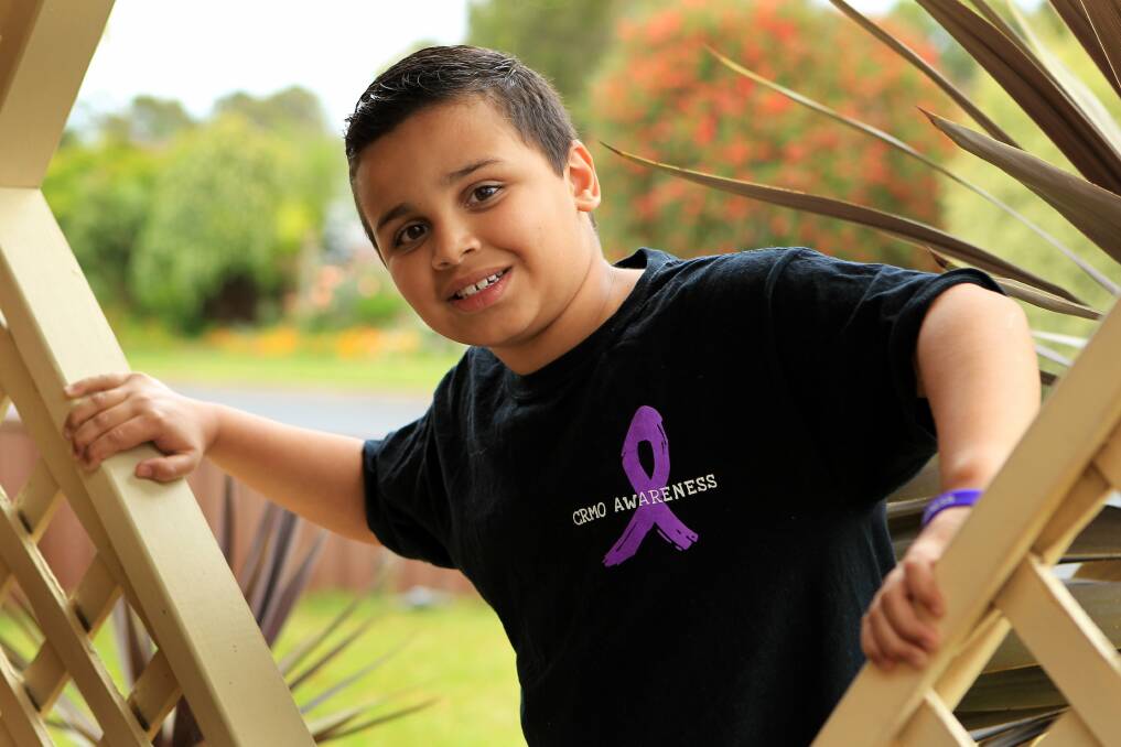 Luke De Silva won't let a rare disease stop him. Picture: Jeff de Pasquale